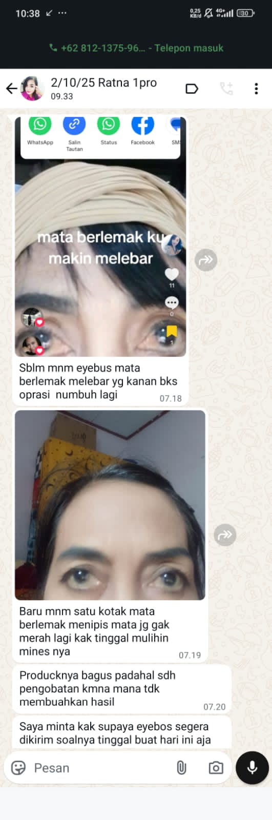 LEMAK MATA DAN MINUS