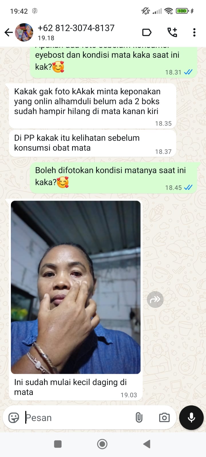 LEMAK MATA