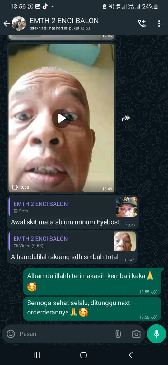 sebelumsesudah